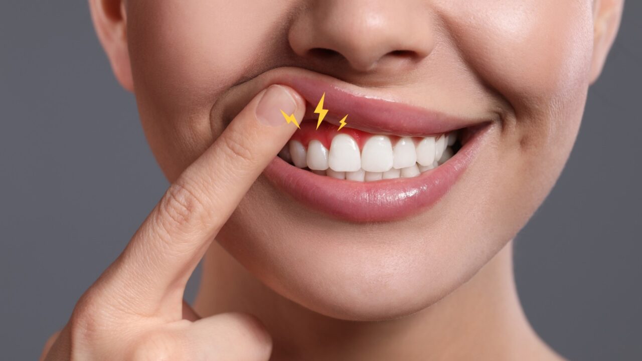 Gum Disease Awareness
