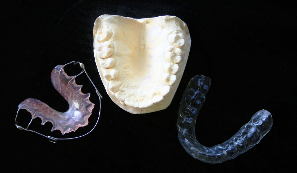 The Importance of Mouthguards in Sports