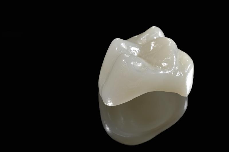 porcelaincrowns_img https://fsm.dp20.net/wp-content/uploads/2024/03/porcelaincrowns_img.jpg